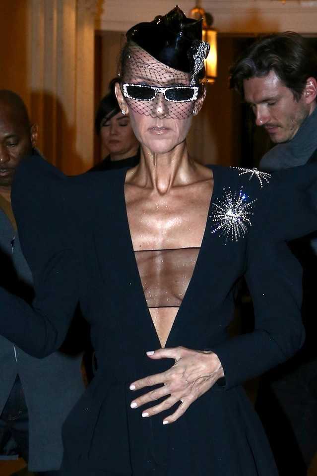 Celine Dion chorobliwie wychudzona. Artystka przerwała milczenie