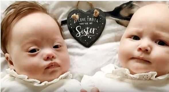 Małżeństwo zamarło, kiedy ujrzało nowo narodzone bliźnięta. Lekarze zaczęli przepraszać