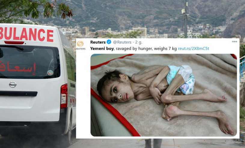 Umierający z głodu siedmiolatek w ostatniej chwili dotarł do szpitala. Waży siedem kg