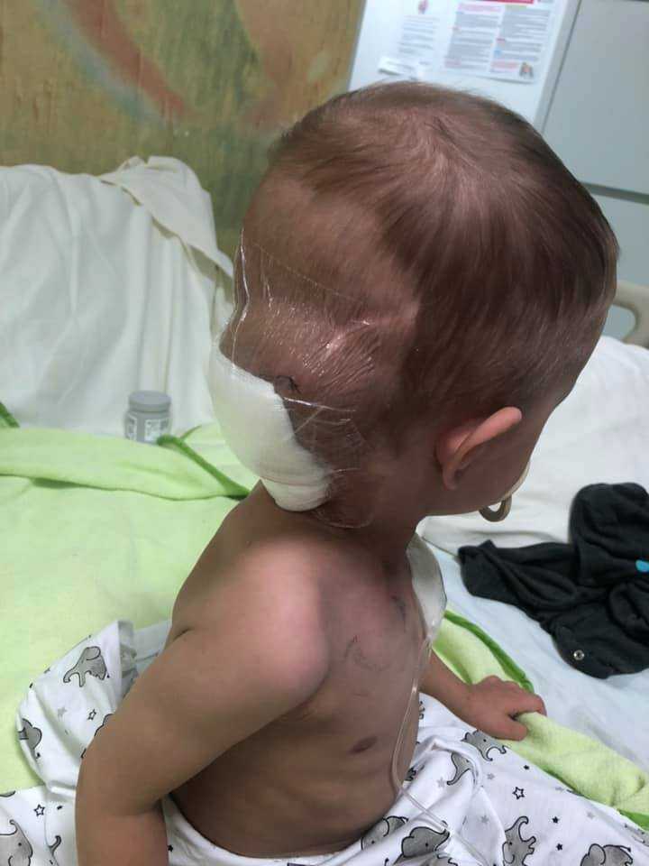 Niespełna 2-letni Marcel przegrał walkę z rakiem. Wzruszająca prośba rodziców