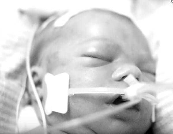 Dziecko zmarło od razu po urodzeniu. 10 miesięcy później cud doprowadził lekarza do łez