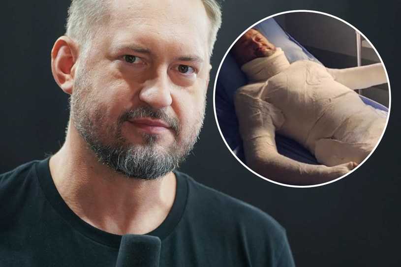 „Zagipsowany” Marcin Prokop pozdrawia ze szpitalnego łóżka. „Wyrazy najgłębszej empatii”