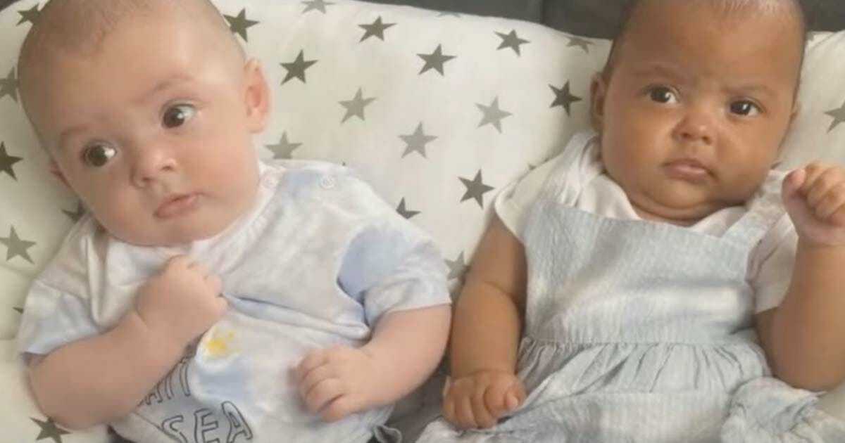 Na porodówce zapadła cisza, gdy położona pokazała matce bliźnięta o różnym kolorze skóry – zobacz jak wyglądają dziś